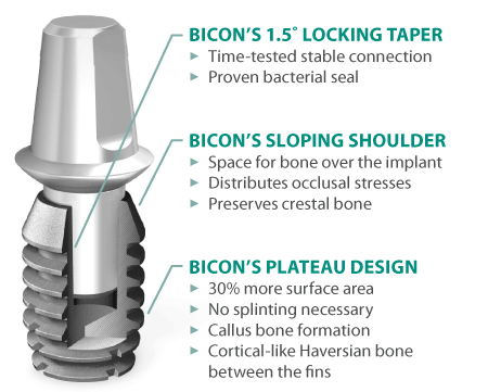 Bicon Implants